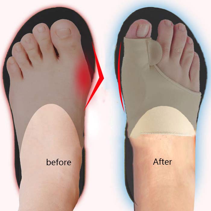 CorrectiveSocks, korekčné ponožky - Image 3