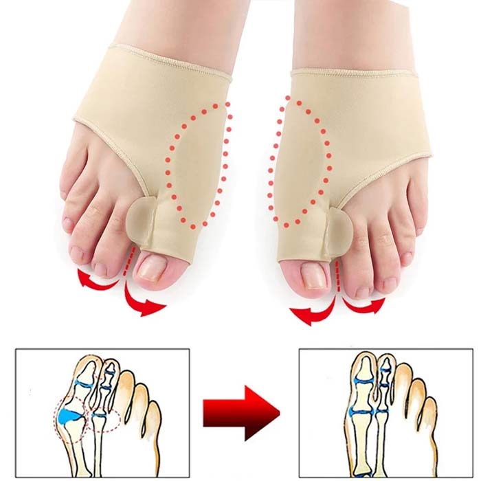 CorrectiveSocks, korekčné ponožky - Image 5