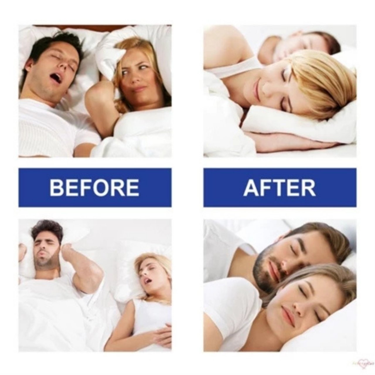 MouthTape, sada pásků na ústa pro klidný spánek (30 kusů) - Image 10